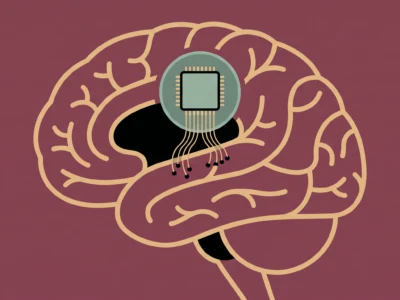 Chiny wszczepiły pierwszy komercyjny implant mózgowy Neuralink ma konkurenta - Promptowy Chiny wszczepiły pierwszy komercyjny implant mózgowy. Neuralink ma konkurenta