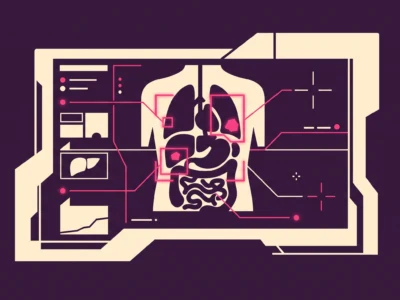 Francuski startup Raidium wdrożył platformę radiologiczną opartą na AI w Moffitt Cancer Center